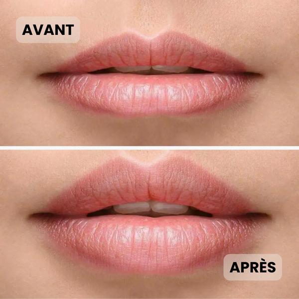 Repulpeur Lèvres – Effet injection sans aiguille