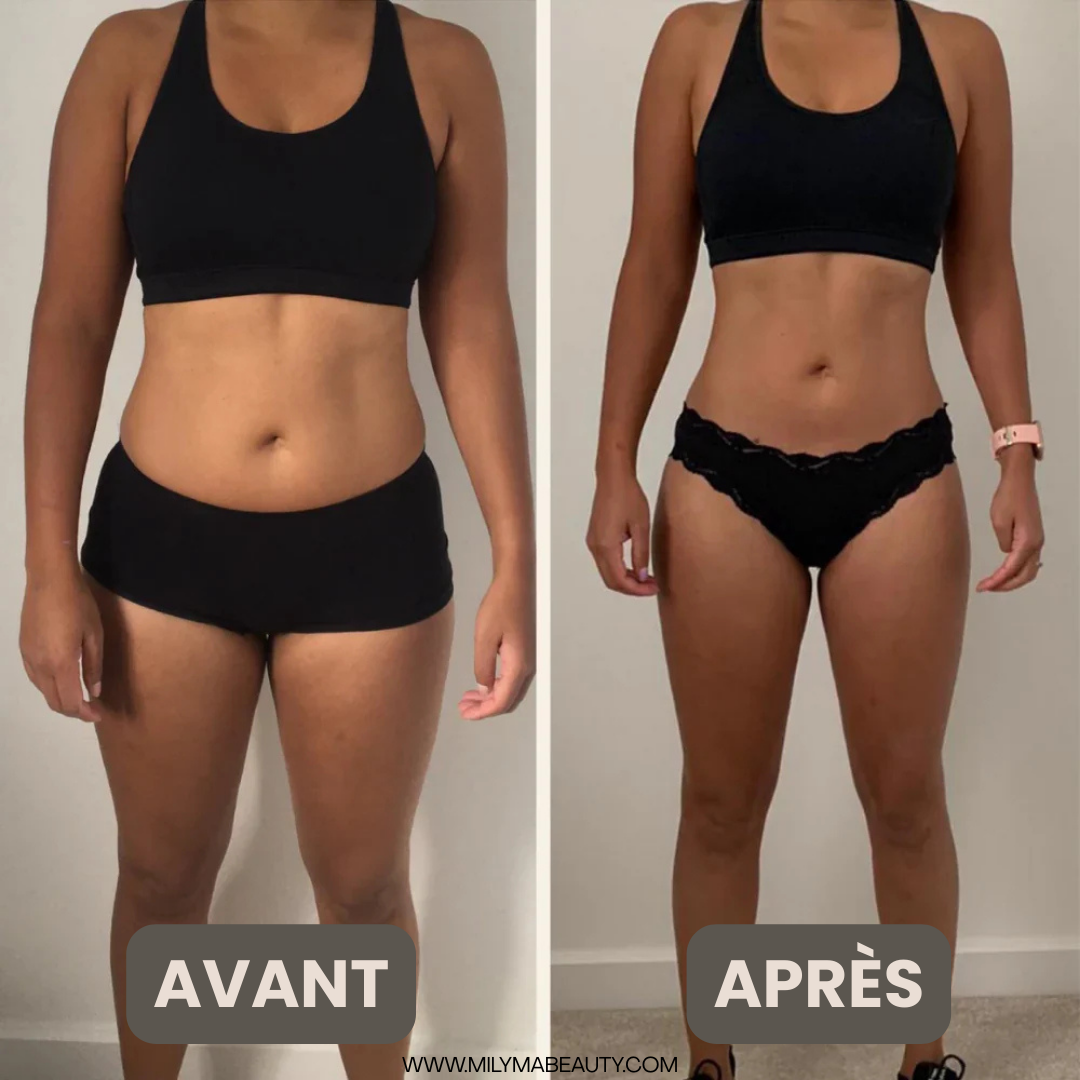 DreamBody - Crème Raffermissante Anti Cellulite & Vergetures