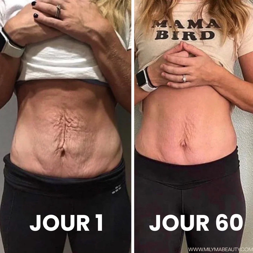 DreamBody - Crème Raffermissante Anti Cellulite & Vergetures