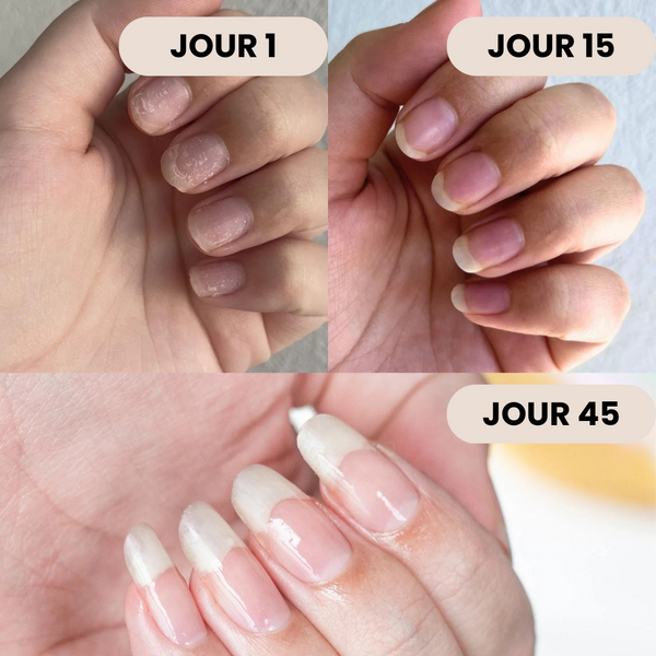Sérum Ongles Renfort+ – Fini les ongles Mous & Cassants