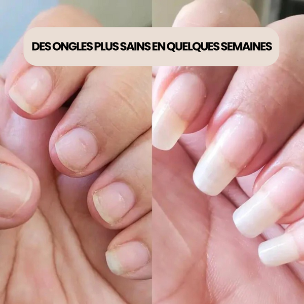 Sérum Ongles Renfort+ – Fini les ongles Mous & Cassants