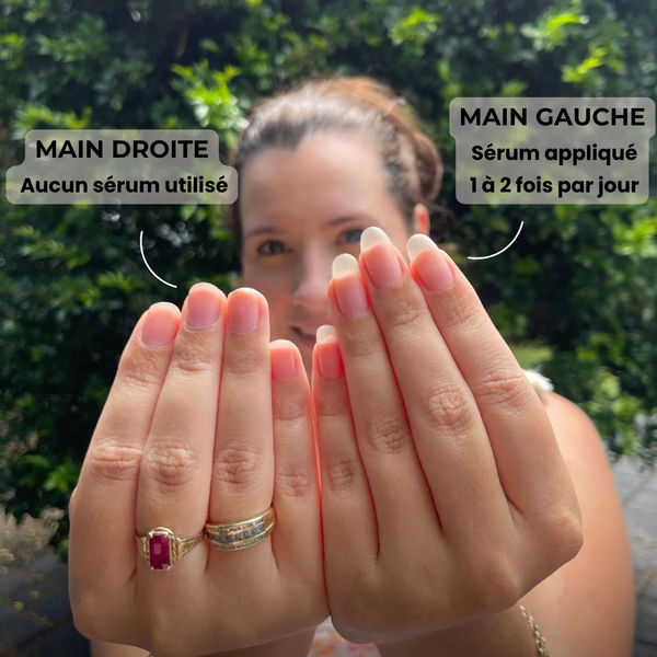 Sérum Ongles Renfort+ – Fini les ongles Mous & Cassants