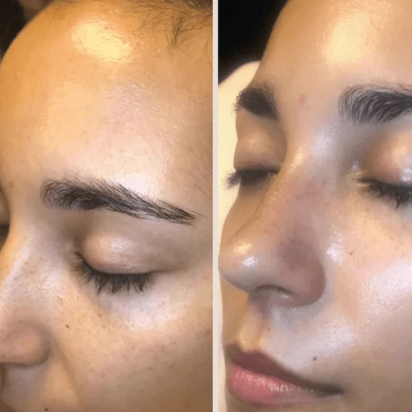 Exfolie ta peau sans la brûler – Peeling doux au riz pour peaux sensibles