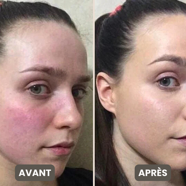 Vitamine C Capsule Crème – Éclat, Hydratation, Correction