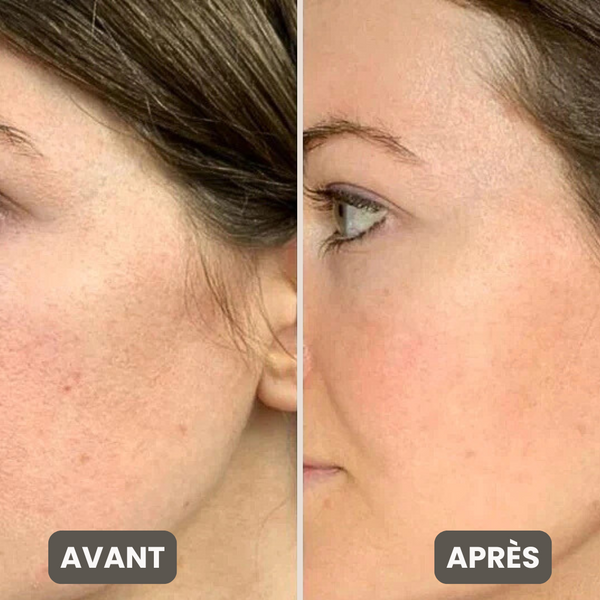 Vitamine C Capsule Crème – Éclat, Hydratation, Correction
